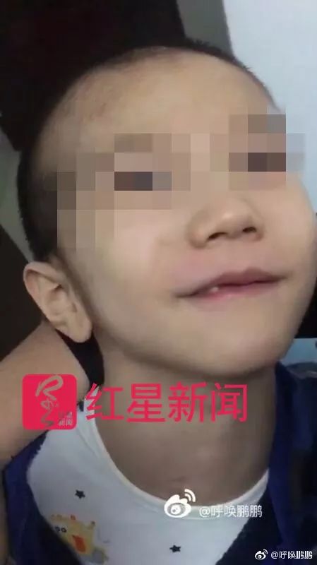 女童遭老师砸伤引发社会深思，背后的原因与抗诉驳回之路探究