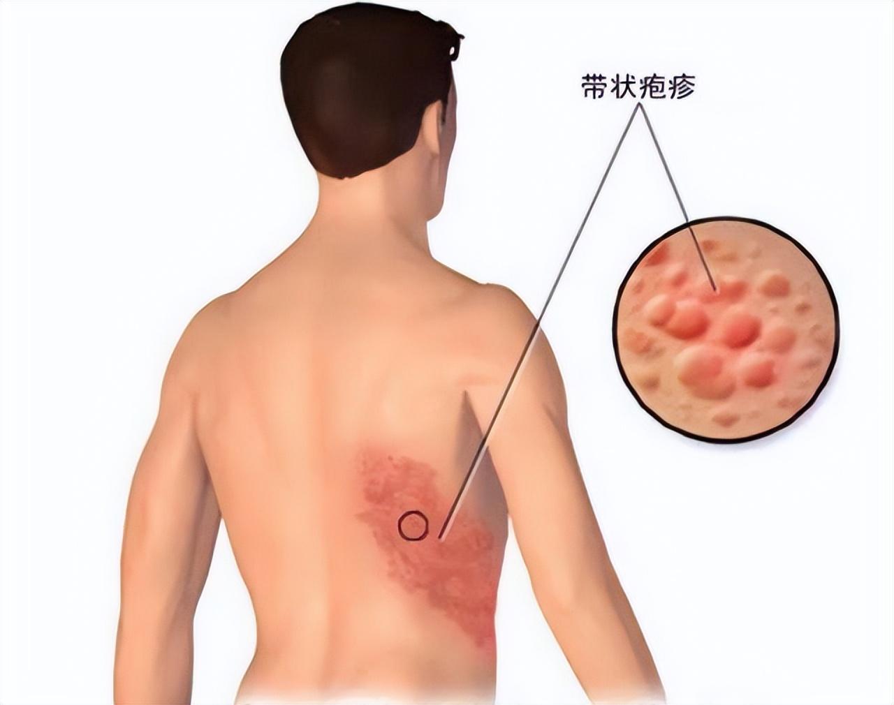 探寻癌症发现之路，患者身边的癌症发现经历与途径揭秘