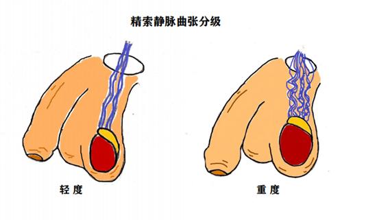 男科关注，男性健康与幸福生活共筑之路